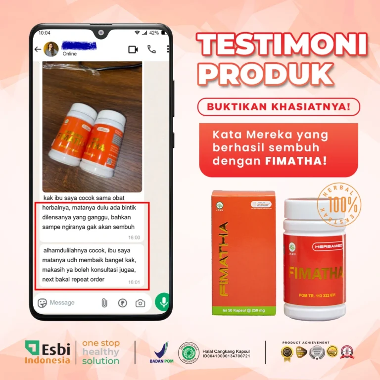 bintik-lensa.webp